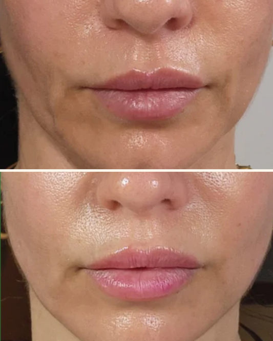 Adipeau Volume Cream